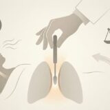 睡眠時無呼吸症候群の手術にリスクはある？痛み・後遺症・再発の可能性と、受ける前の注意点