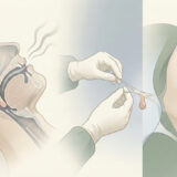 いびきの原因はのどちんこ（口蓋垂）の長さ？大きい・垂れ下がっている人の治療法と切除手術