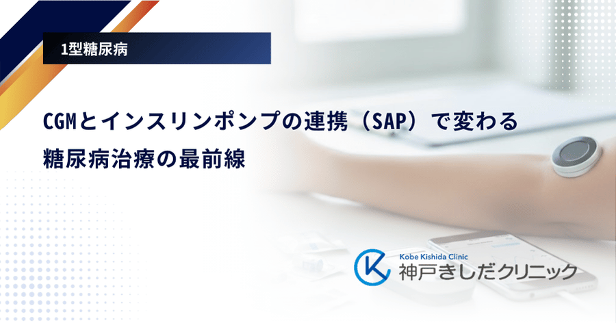 CGMとインスリンポンプの連携（SAP）で変わる糖尿病治療の最前線