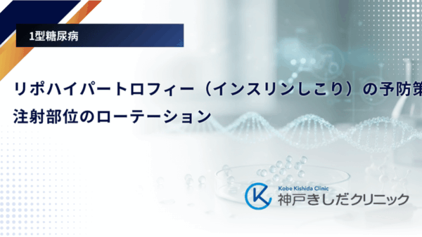 リポハイパートロフィー（インスリンしこり）の予防策｜注射部位のローテーション