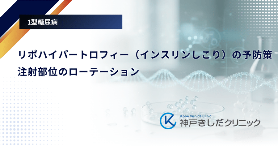 リポハイパートロフィー（インスリンしこり）の予防策｜注射部位のローテーション