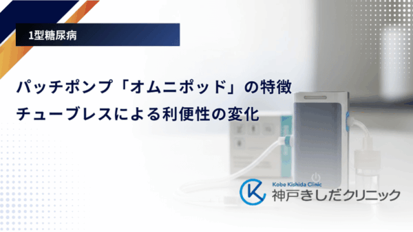 パッチポンプ「オムニポッド」の特徴｜チューブレスによる利便性の変化