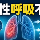 急性呼吸不全に関する医療記事のアイキャッチ画像