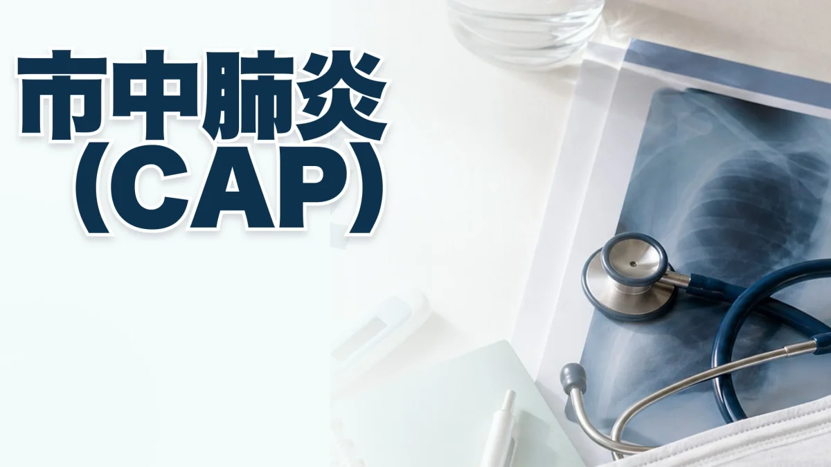 市中肺炎(CAP)に関する医療記事のアイキャッチ画像