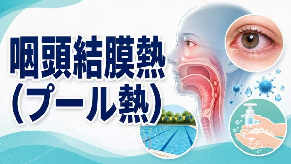 咽頭結膜熱（プール熱）(Pharyngoconjunctival Fever) – 呼吸器疾患