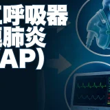 人工呼吸器関連肺炎（VAP）に関する医療記事のアイキャッチ画像