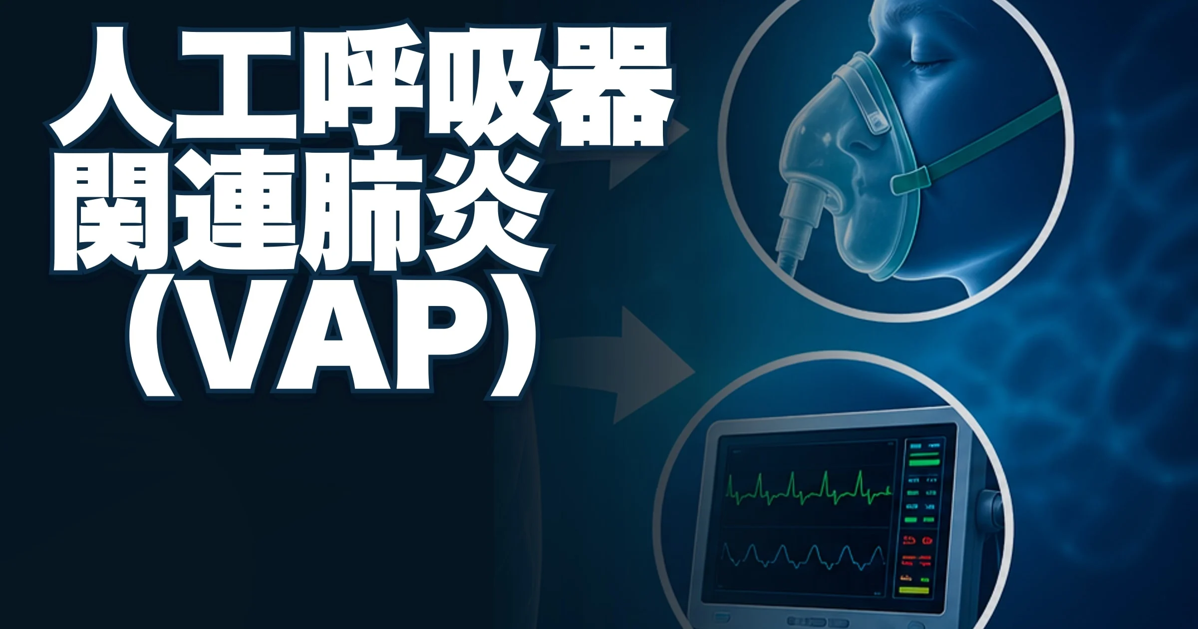 VAP. Ventilator-associated pneumonia -
