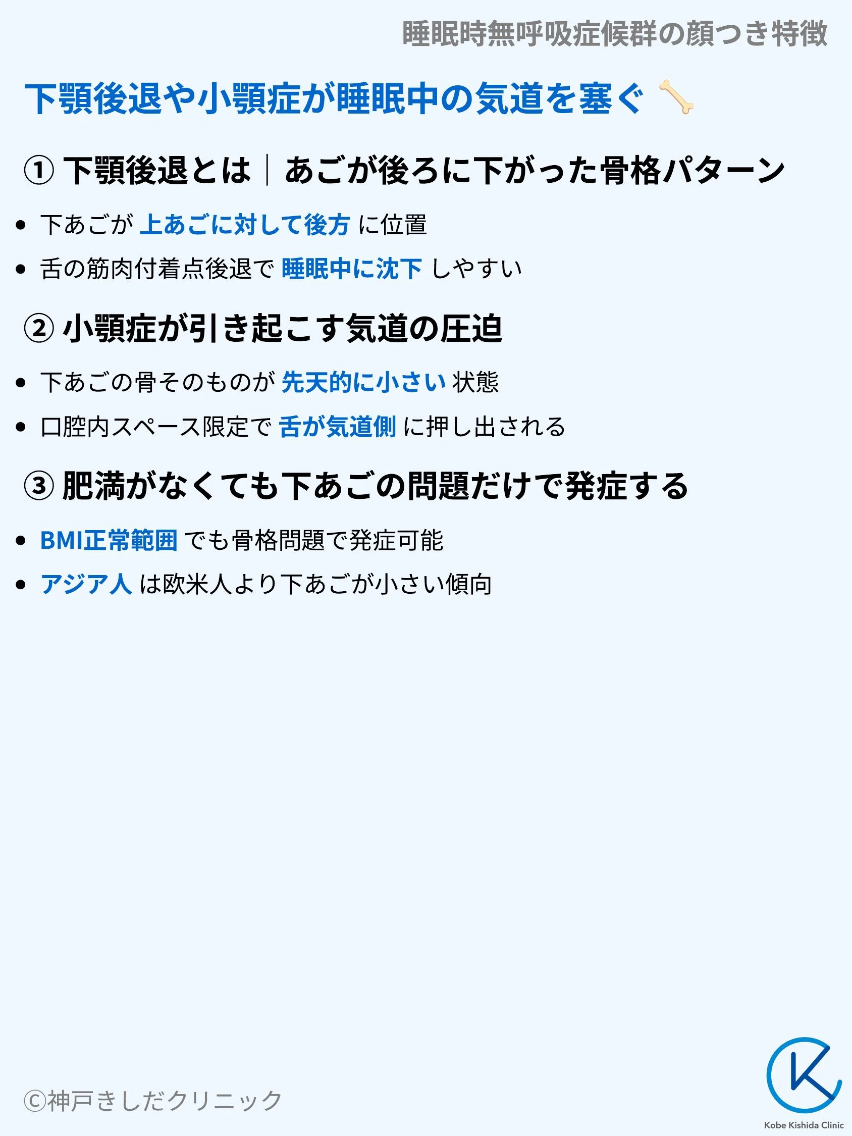 睡眠時無呼吸症候群の顔つき特徴_04.webp