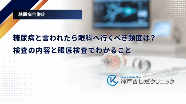 糖尿病と言われたら眼科へ行くべき頻度は?検査の内容と眼底検査でわかること