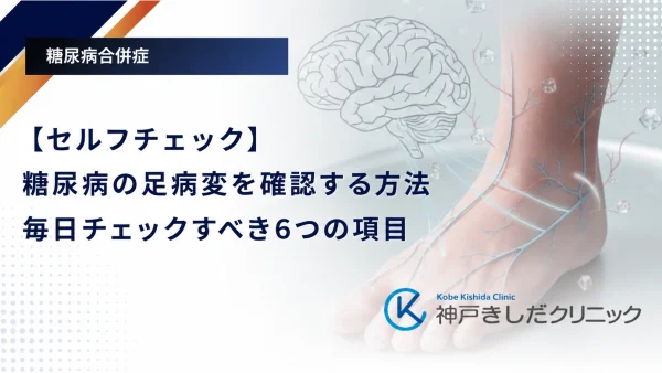 【セルフチェック】糖尿病の足病変を確認する方法|毎日チェックすべき6つの項目