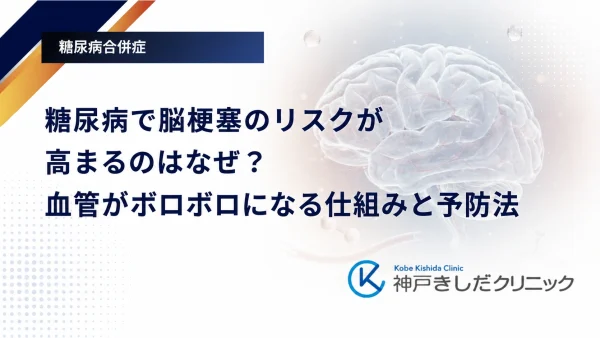 糖尿病で脳梗塞のリスクが高まるのはなぜ?血管がボロボロになる仕組みと予防法