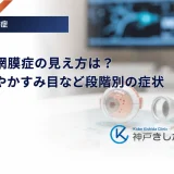 糖尿病網膜症の見え方は？飛蚊症やかすみ目など段階別の症状
