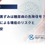 足の指の黒ずみは糖尿病の危険信号？血流悪化による壊疽のリスクと受診の目安