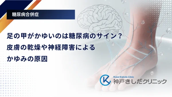 足の甲がかゆいのは糖尿病のサイン？皮膚の乾燥や神経障害によるかゆみの原因