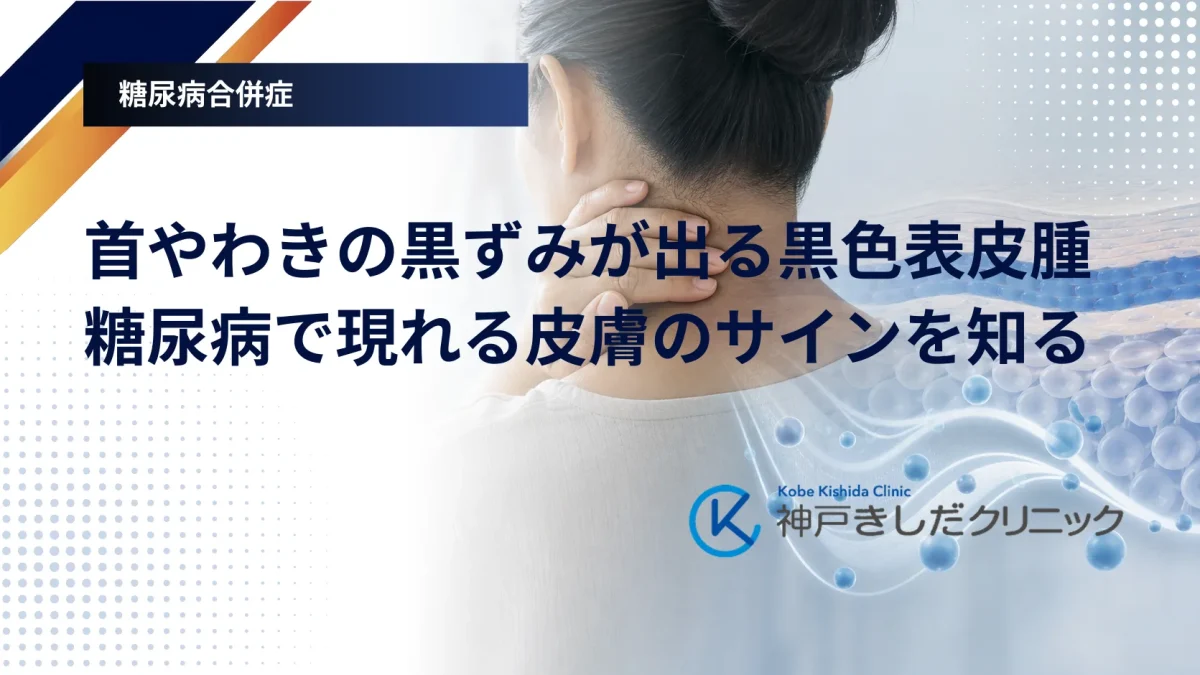 首の後ろやわきの皮膚の変化とインスリン抵抗性をイメージした医療グラフィック