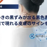 首やわきの黒ずみが出る黒色表皮腫｜糖尿病で現れる皮膚のサインを知る