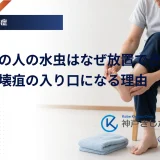 足の指の間を確かめる場面を示した糖尿病フットケアのイメージ