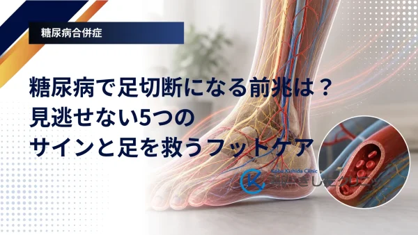 糖尿病で足切断になる前兆は？見逃せない5つのサインと足を救うフットケア