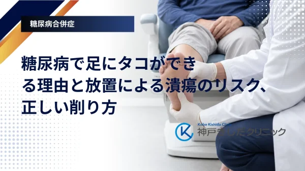 糖尿病で足にタコができる理由と放置による潰瘍のリスク、正しい削り方