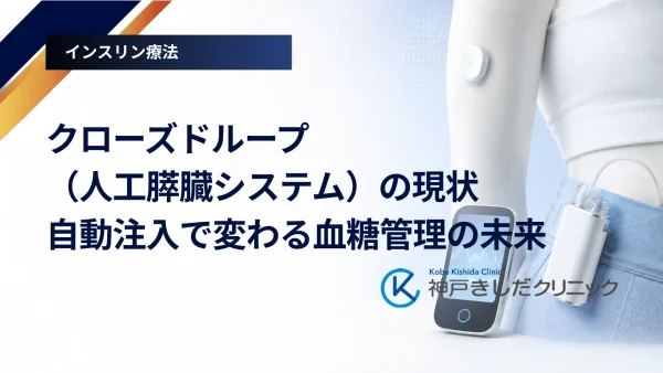 クローズドループ（人工膵臓システム）の現状｜自動注入で変わる血糖管理の未来