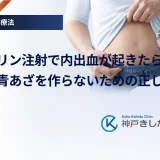 インスリン注射で内出血が起きたら？原因と青あざを作らないための正しい技術