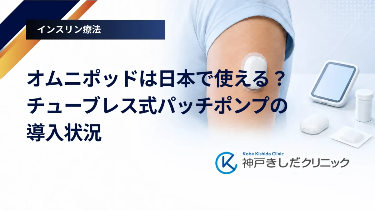 オムニポッドは日本で使える？チューブレス式パッチポンプの導入状況